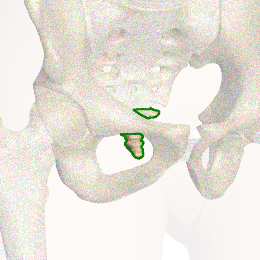 PICTURE: ANATOMICAL RENDERING OF COCCYX