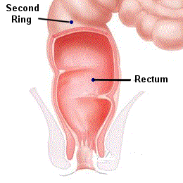 PICTURE: ANATOMICAL RENDERING OF RECTUM