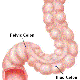 PICTURE: ANATOMICAL RENDERING OF SIGMOID COLON